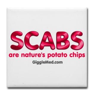 Scab Potato Chips  Shop GiggleMed