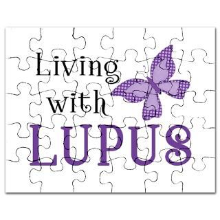 Living with Lupus  APS Foundation of America Inc E Store