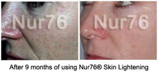 NUR76 Skin Lightening Cream Whitening Whitener Nur 76