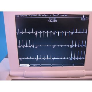 GE Marquette MAC 5000 12 Lead Resting ECG EKG Monitor W/ Cart & 60 Day