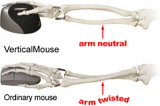 Vertical Mouse sorgt durch Ihre Form dafür, dass der Arm sichbei der